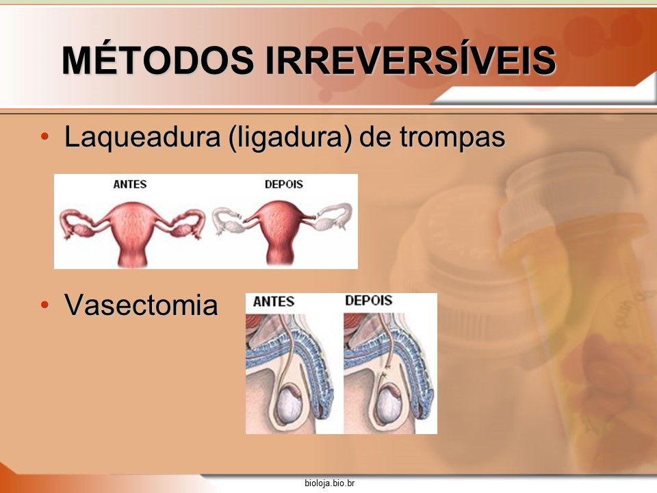 Métodos anticoncepcionais slide 3