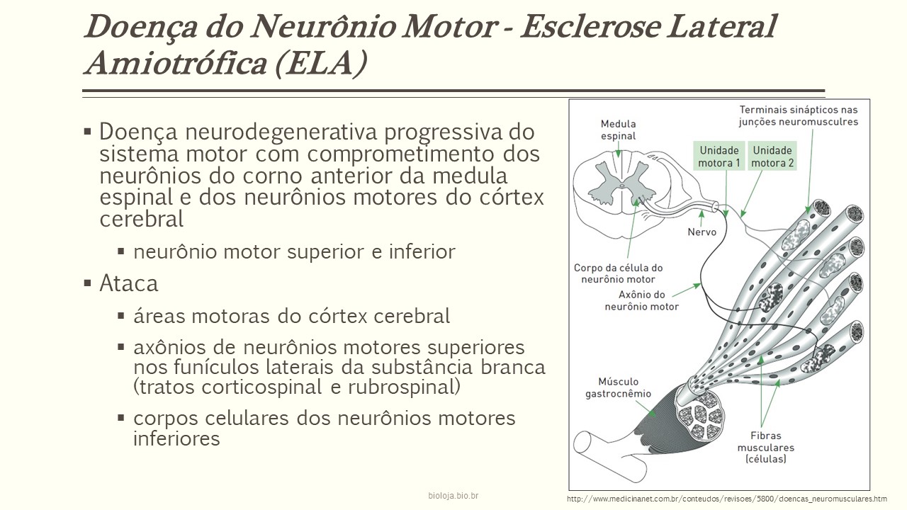 Esclerose Lateral amiotrófica (ELA) slide 1