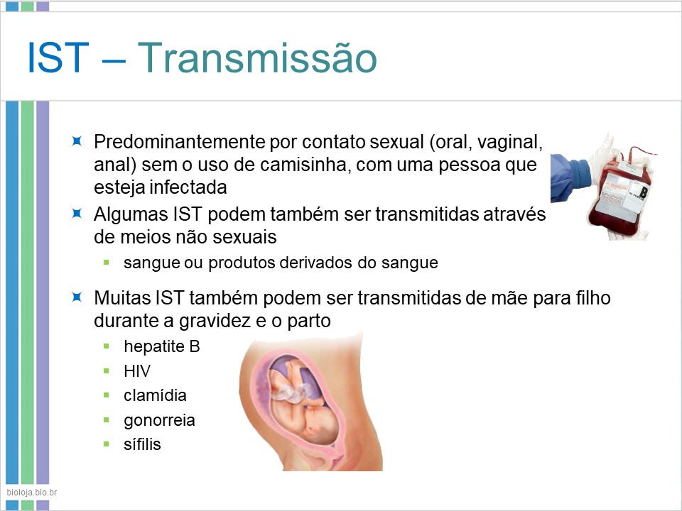Infecções sexualmente transmissíveis 1 (IST-1) slide 4